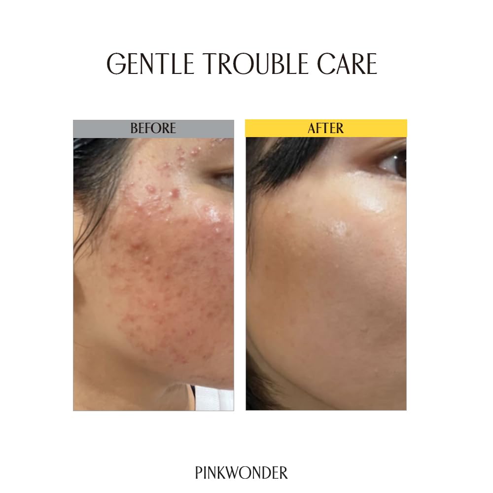 PINKWONDER Tamanu Hero Ampouleโบ 1.69oz (50ml), 50,000ppm Tamanu Oil for Soothing