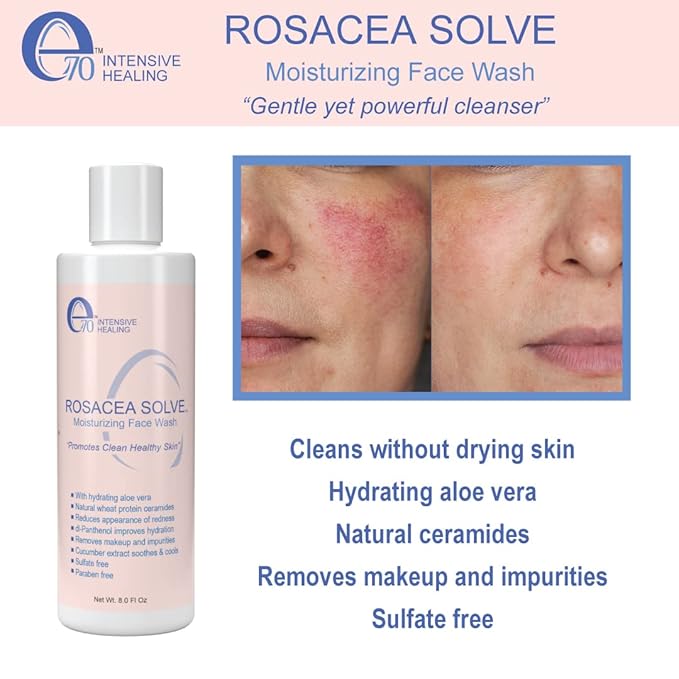 Rosacea solve moisturizing face wash