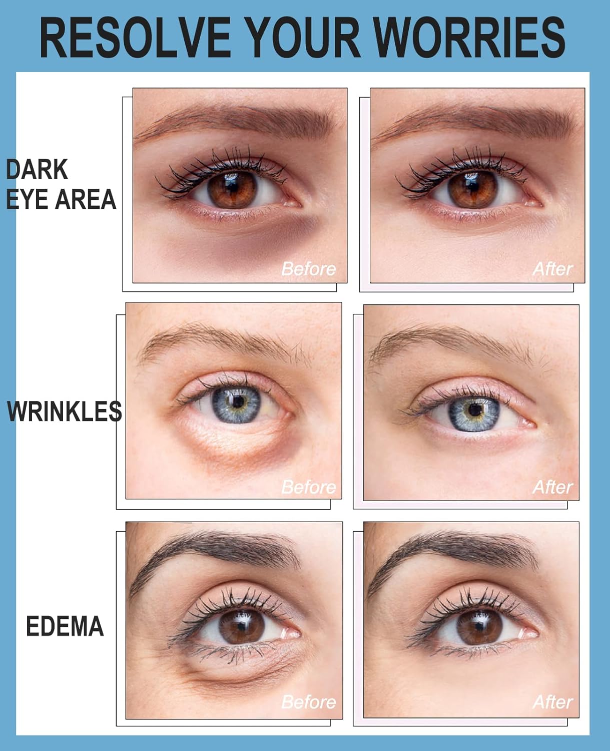 Hydrogel Eye Patches for Wrinkles, Under Eye Gel Pads For Puffy Eyes and Dark Circles, Collagen Eye Mask Skincare Pink Color