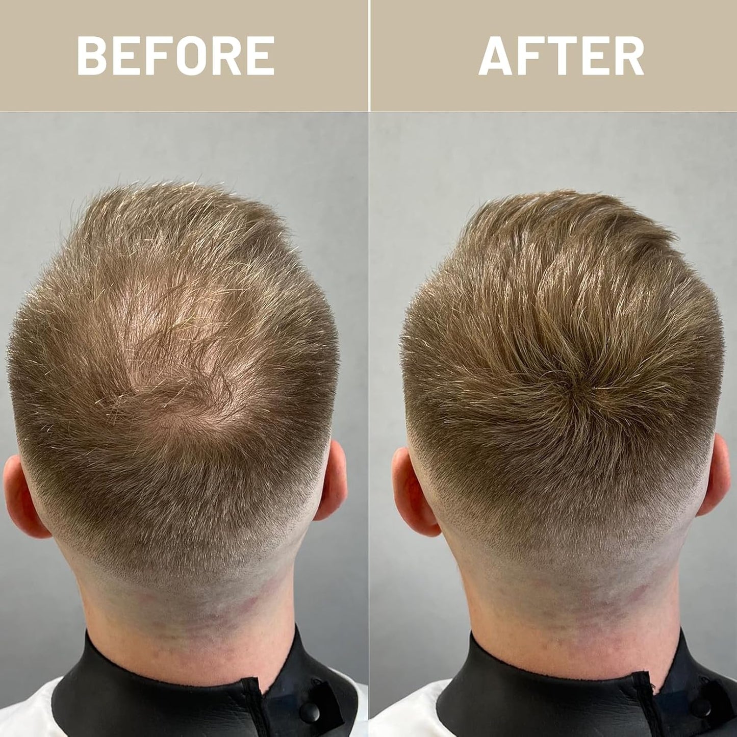 VOLLUCK Hair Fibers for Thinning Hair, Instant Coverage Hair Building Fibers for Women and men, Natural Hair Powder for Conceal Hair Loss 28 g (Light Blonde)