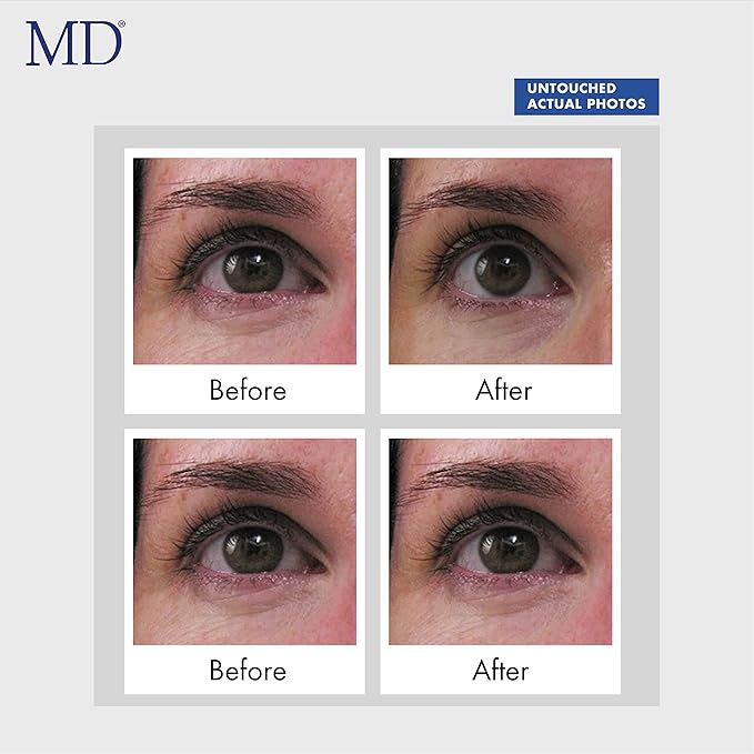 Md ultimate eye cream ??under