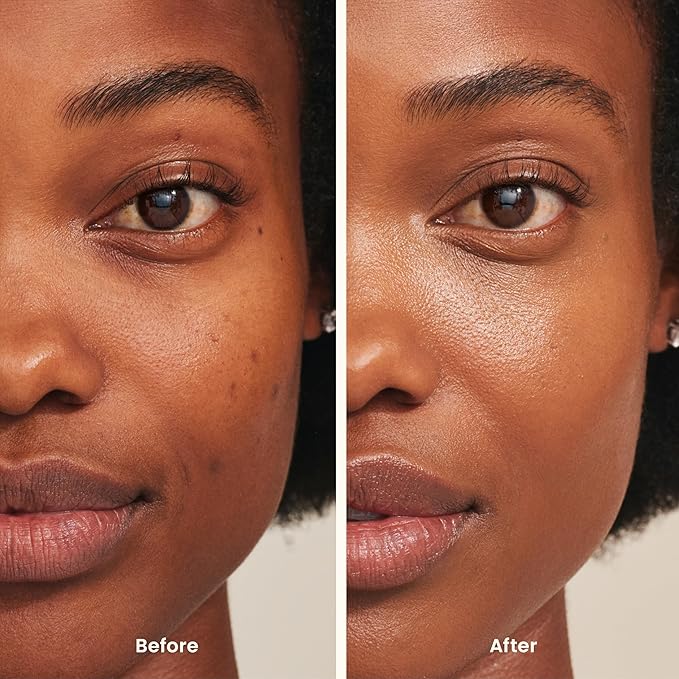 Joah perfect complexion under eye