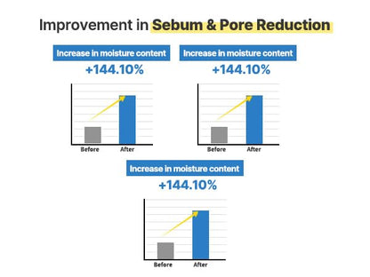AQUA SQUALANE SERUM | Deeply hydrated Facial Serum for All Skin Type, Soothing, Pore Tightening and Sebum control Benefits, Korean Skin Care (1.69 Fl.Oz)