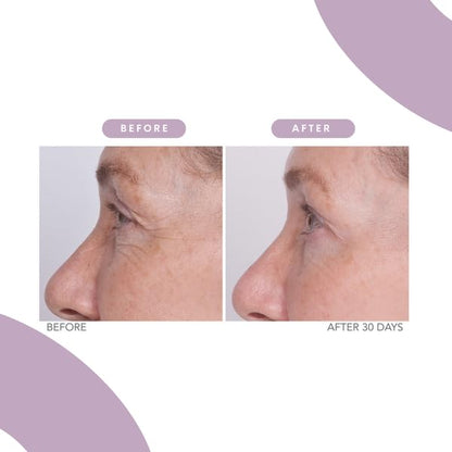 Serious Skincare - Reverse Lift Eye Cream Moisturizer with Peptides, Bladderwrack Seaweed - Skin Firming and Lifting Wrinkle Formula - Women, Men - Temporarily Lift & Firm Eye Area - 1 oz.