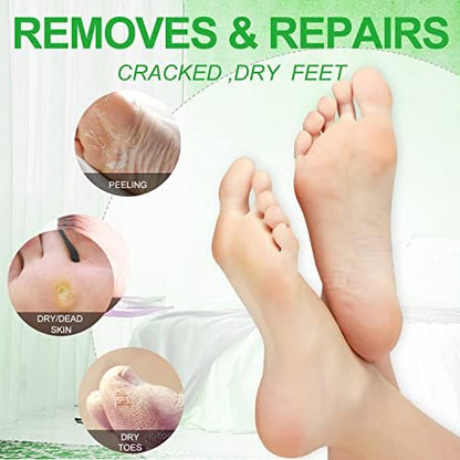 Pedicure Kit Foot Soak Set: Bubble Salt, Sugar Scrub, Massage Mask, Massage Lotion in a Box, 4 Step Foot Spa Kit for Dry Feet, Calluses and Tired Feet (1 Set Jasmine)