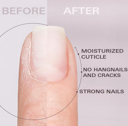 Cuticle Oil Pen Vacation Mood Set of 3 - Pineapple, Peach, Watermelon Scents