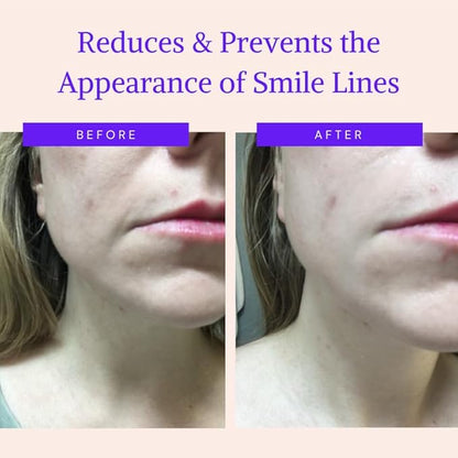 Blumbody face wrinkle patches -