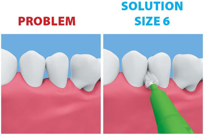 Piksters Interdental Brushes, Size 6, 100 Count (10 x 10 Packs), Interdental Tooth Brush for Larger Gaps, Gum Soft Bristles for Plaque Removal, Safe for Braces (100pk)