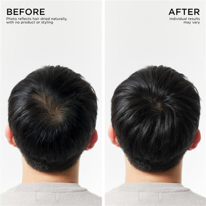 Dr. Groot Hair Thickening Shampoo, Korean Hair Care with Biotin, Rosemary Oil to Help Volumize Thinning, Damaged Hair, Hydrate Hair and Scalp, Biotin Shampoo, Scalp Revitalizing Solution