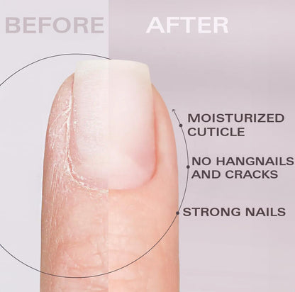 Cuticle Oil Pen - Strawberry Scent, Vitamin E Nail Strengthener and Growth Serum for Nail Care, Nourishing and Hydrating Formula for Healthier, Stronger Nails