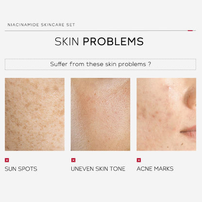 Niacinamide Skincare Set: 4pcs Beauty Kit with Cleanser, Toner, Serum, & Facial Cream - Hydrates & Evens Skin Tone - TSA-Friendly Travel Sizes, Perfect Gift for Women, Moms, & Teens