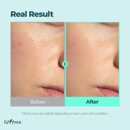 ISNTREE Gim PDRN Hydro Bouncy Ampoule 50ml, 1.69 fl oz | Korean SEAWEED Skincare Facial Serum | Water Jelly Texture | Hydrating & Firming | Multi-Hyaluronic Acid + Collagen Boost | Pore-Refining Glow