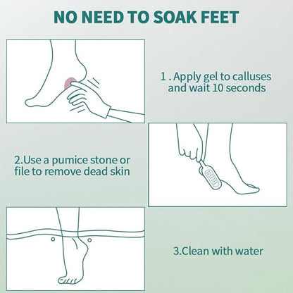 Gorgellux callus remover for feet,