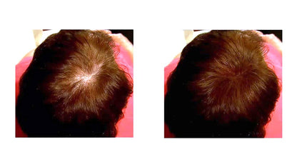 Caboki Hair Building Fiber. (30G, 90-Day Supply). Auburn