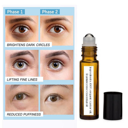 Time Eraser Oil, 2PCS Time Eraser Roller Ball Castor Oil, Time Eraser for Puffy Eye Bags Fine Lines Dark Circles Wrinkles with 360° Eye Roller Massage Ball