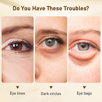 Soothing Eye Cream for Under Eye Bags and Wrinkles, Anti-Aging, 0.5 Fl Oz (Pack of 1)