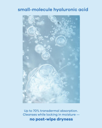 Flushable Feminine Hygiene Wipes, with Hyaluronic Acid & Natural Plants Essential Oils, Individually Wrapped, For Odor, Itching, Redness, Deeply Cleansing,15x19cm, 18 count