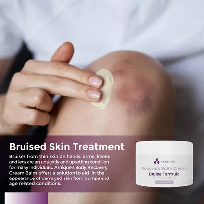 Arnica Bruise Cream with Vitamin K, Extra Strength Fast Healing Thin Skin Formula, Senile Purpura or Redness, Visibly Aide Remove Bruises Elderly and Fragile Skin, Surgery Aftercare