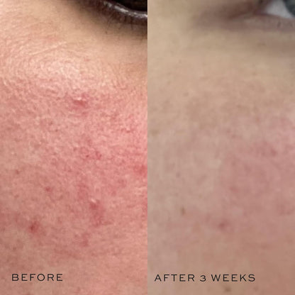 DIME Beauty Super Skin Toner, Alcohol-Free Witch Hazel Toner, Hydrating for Face with Aloe Vera and Cucumber Extract, 4 oz / 120 ml