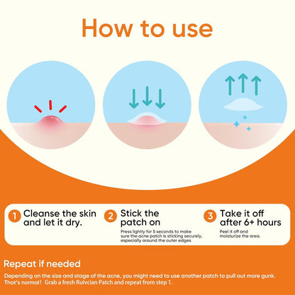 Microdart Acne Patches for Face(18 Counts) & Salicylic Acid Pimple Patches(36 Counts), Fast-Acting Zit Patches for Pimples & Blemishes, Target Early Stage & Deep Pimples