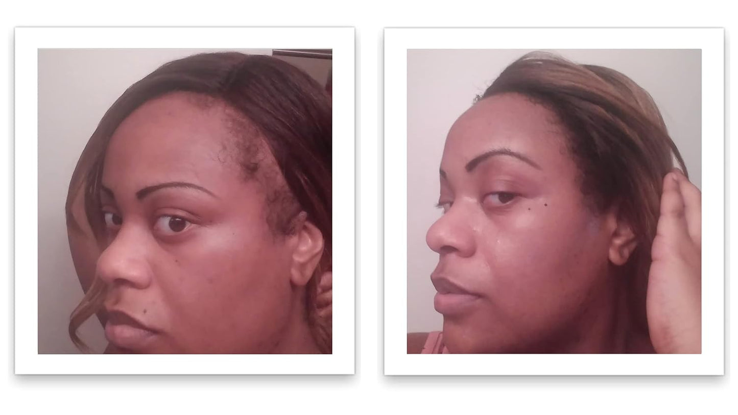 Caboki Hair Loss Concealer, All-Natural Hair Building Fiber. Make Thin Hair Look 10X Fuller Instantly. Eliminate the Appearance of Bald Spot and Thinning Hair (30G, 90-Day Supply). Black