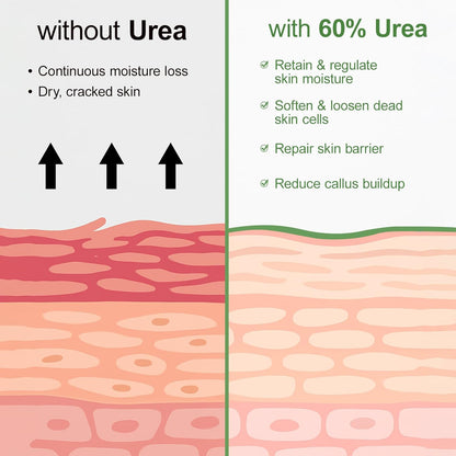 Urea Cream 60 Percent For Feet Maximum Strength Plus Salicylic Acid 2%, Tea Tree Foot Lotion For Dry Feetcracked Heels Treatment Athletes Foot Cream Intensive Repair Foot Moisturizer Care 5.29oz