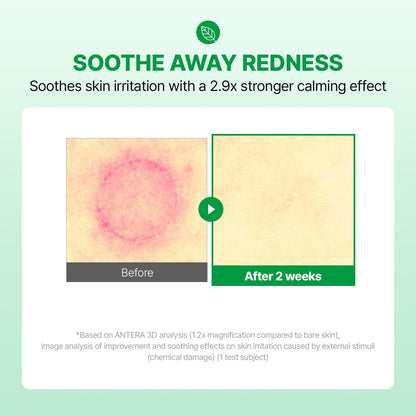 MAKE P:REM INTECA Soothing Cream, Quick Calming Facial Cream with Advanced CICA for Acne-Prone Skin, All Skin Types, EVE VEGAN, Korean Skin Care, 2.70 fl.oz., 80ml