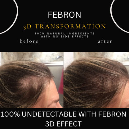 FEBRON Hair Fibers For Thinning Hair MEDIUM BROWN Giant 30G For Women & Men Hair Loss Concealer Hair Powder Volumizing Based 100% Undetectable & Natural - Bold Spots Filler