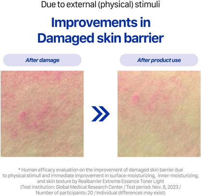 Real Barrier Extreme Essence Toner Light 6.76 Fl Oz | Hyaluronic Acid Panthenol Face Moisturizer for Sensitive Dry Skin | Soothing & Hydrating Moisturizing Toner for Face | Korean Skin Care