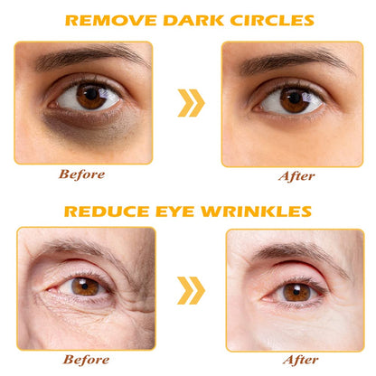 24K Gold Eye Mask, 30 Pairs Under Eye Masks for Dark Circles and Puffiness Treatment, Under Eye Patches for Puffy Eyes and Eye Bags, Gel Eye Mask Eye Pads for Face Skin Care