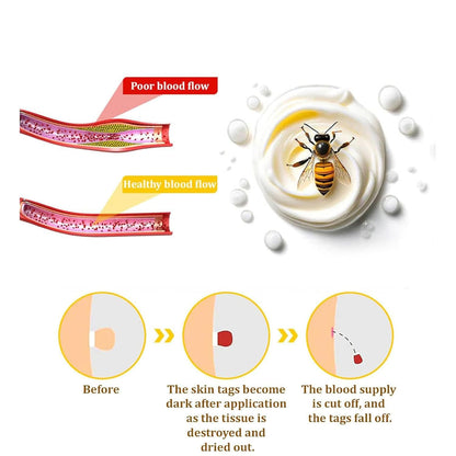 Bee Venom Skin Treatment Cream, Bee Venom Repair Cream, Suitable for All Skin Types