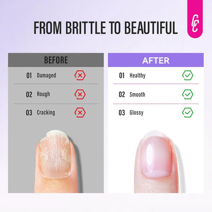 CHUCHU Nail Strengthener and Repair Kit: Pink Hardener and Growth & Cuticle Softener Set - Protein Ridge Filler Polish Quick Dry for Weak Peeling Brittle Splitting Nails - for Women Home Salon