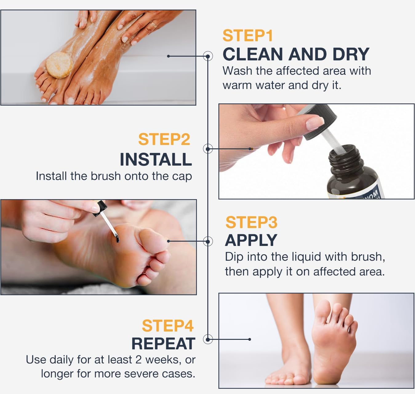 Bee Venom Skin Wart Remover: Fast-Acting 20% salicylic Acid Skin Wart Remover for Plantar Wart, Genital Wart