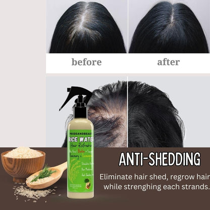 NEW Fermented Rice Water for Hair Growth - Infused with Rosemary, Biotin, Caffeine, Keratin Vegan Non-Greasy Spray Naturally Thicker, Longer, Softer Men & Women (12 OUNCES, Rosemary Lemongrass)