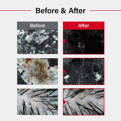 Dr.FORHAIR Folligen Sea Salt Scaler | Korean Hair Care | Scalp Exfoliator & Scalp Scrub | Eliminates Sebum, Impurities, Odor | Nourish and Freshen, 10.58 fl oz