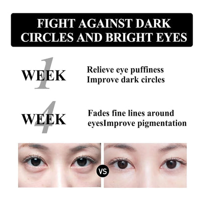 Firming Eye Cream, Snake Venom Peptide Eye Cream, Daily Anti-Aging Under Eye Cream, Remove Pouches Dark Circles Anti-Wrinkle Diminishing Eye Lines Lifting Firming