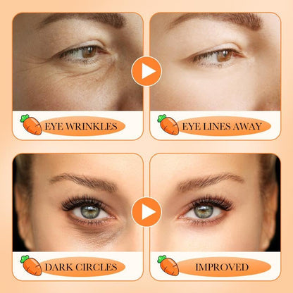Carotene Eye Cream Moisturizes, Carrot Vita Eye Cream, Eye Wrinkles and Eye Bags, Tighten and Firm Eye Skin, Hydrating, Moisturizes Reduces Puffiness