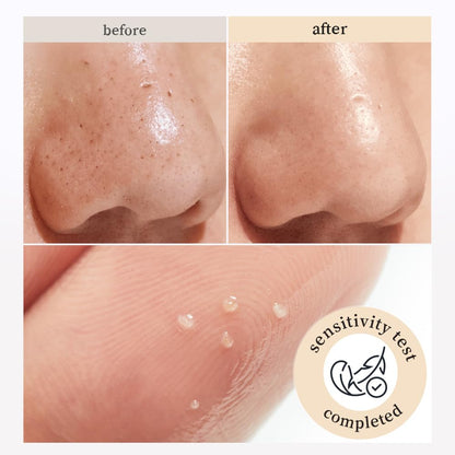 NOONI Korean Cleansing Oil – Snow Aqua 0 Rice Ceramide Barrier Care Cleansing Oil | Makeup Remover, Face Wash, Gentle Facial Cleanser, Pore Care, Korean Skin Care, Vegan, 6.76 Fl Oz