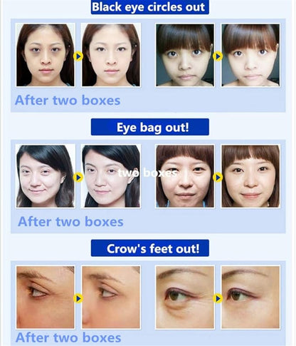 Adofect 30 pairs pink eye