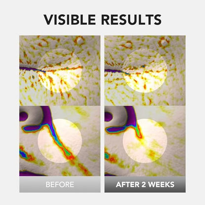 [skin&lab] bakuchiol eye serum with