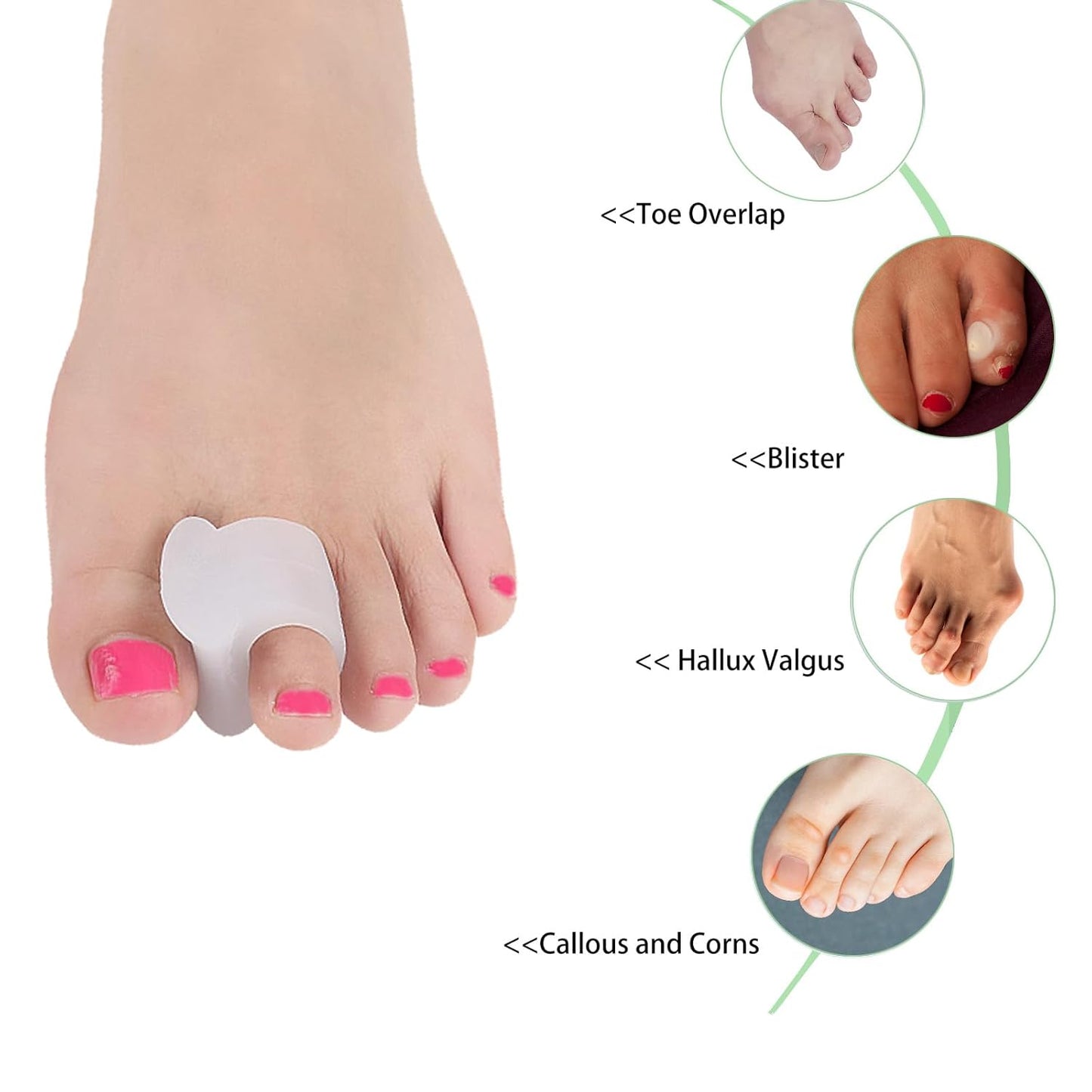 12pcs Gel Toe Spacers include sizes S M L, Toe Separators to Correct Your Toes, Toe Support Big Toe Spacers for Overlapping Toes Bunions Hammer Toe Relaxation Restore Toes to Their Original Shape