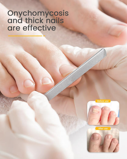 BEZOX Long Metal Nail File, Stainless Steel Fingernail File for Thick and Fungal Nails with Dual-Ended Toenail Lifter – The Ultimate Manicure & Pedicure Tool for Men and Women’s Nail Care - Silver
