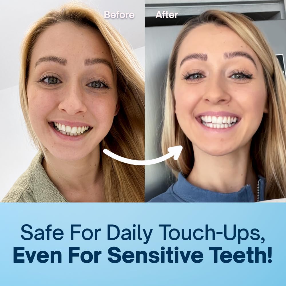 MySweetSmile Precision Teeth Whitening Pen - Pap Formula - Enamel-Safe - Sensitivity-Free - Dentist-Approved - IndyBest Award-Winning Brand - Mint Flavour