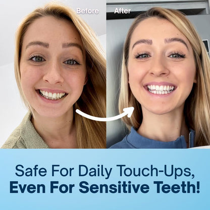 MySweetSmile Precision Teeth Whitening Pen - Pap Formula - Enamel-Safe - Sensitivity-Free - Dentist-Approved - IndyBest Award-Winning Brand - Mint Flavour