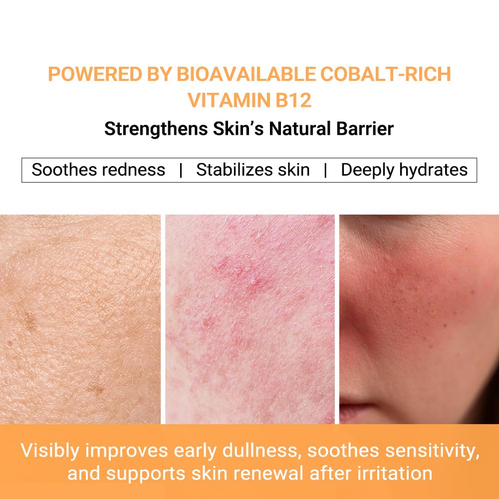 Puretiful Vitamin B12 Lotion (1 oz) | Repair & Hydrating Cream for All Ages （teen & adult)| Soothes Redness, After-Sun Skin Relief, Strengthens Barrier, Sensitive Skin Safe