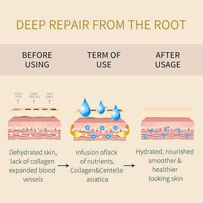 Under eye patches - 60