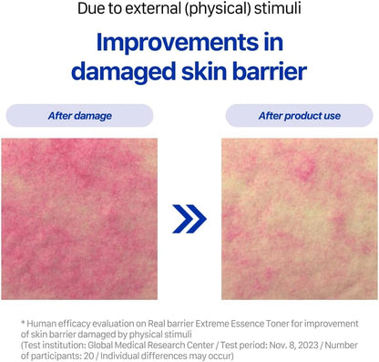 Real Barrier | Extreme Essence Toner | Hyaluronic Acid Panthenol Ceramide Face Moisturizer for Sensitive Dry Skin | Soothing & Hydrating Moisturizing Toner Face | Korean Skin Care | 6.76 fl oz (200ml)