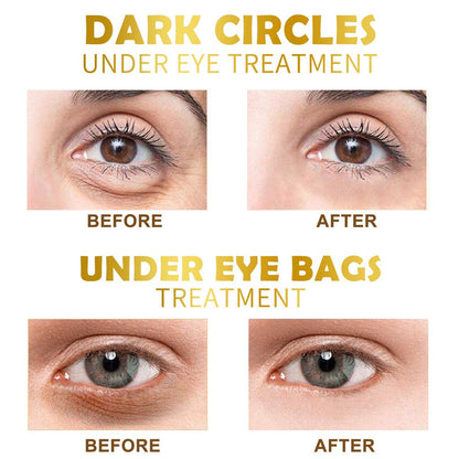 Under Eye Patches, 30 Pairs Gold Eye Mask, Eye Gel Pads With Collagen Treatment for Reducing Dark Circles, Lighten Wrinkles Anti-Aging Moisturizing, Fine Lines Eye Bags Puffiness for Women Men