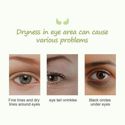 12pcs under eye patches for