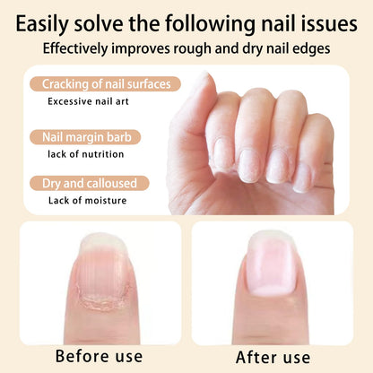 Cuticle Oil Pen Sweet Almond Nail Growth Serum and Repair Treatment Hydrating Oil for Dry Cuticles and Skin Cuticle Buddy Revitalize Nails with Radiant Cosmetics' Nail Growth Oil (6pcs)